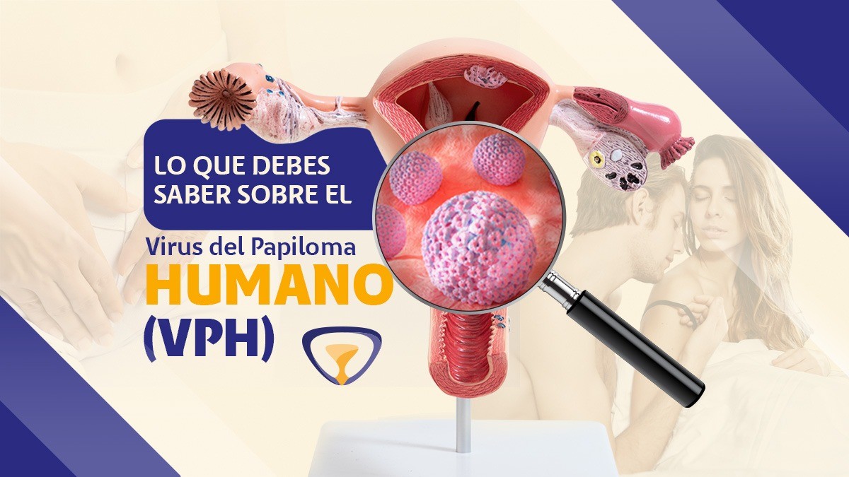 LO QUE DEBES SABER SOBRE EL VIRUS DEL PAPILOMA HUMANO (VPH) | NACER ...