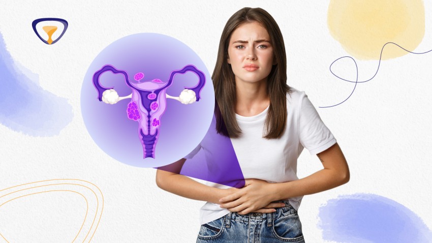 Tratamientos para la infertilidad causada por endometriosis 